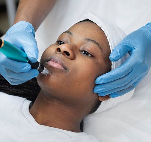 Dermapen