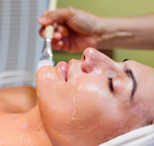 Peeling Químico