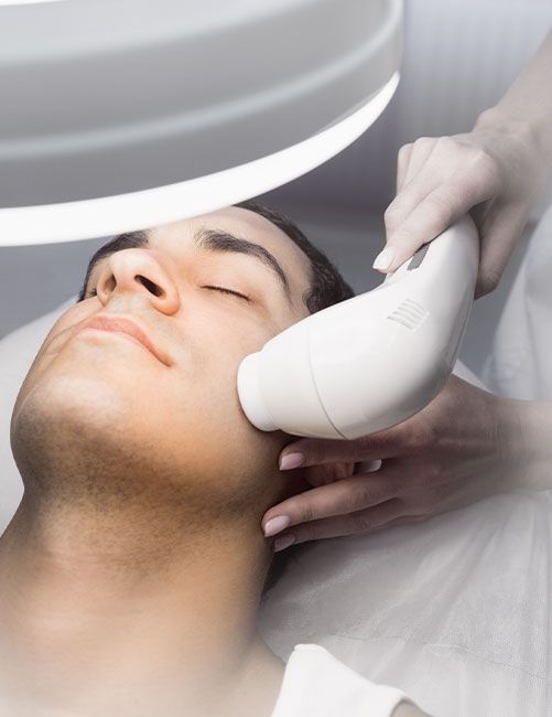 Radiofrecuencia facial